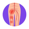 Douleurs nerveuses & Neuropathie